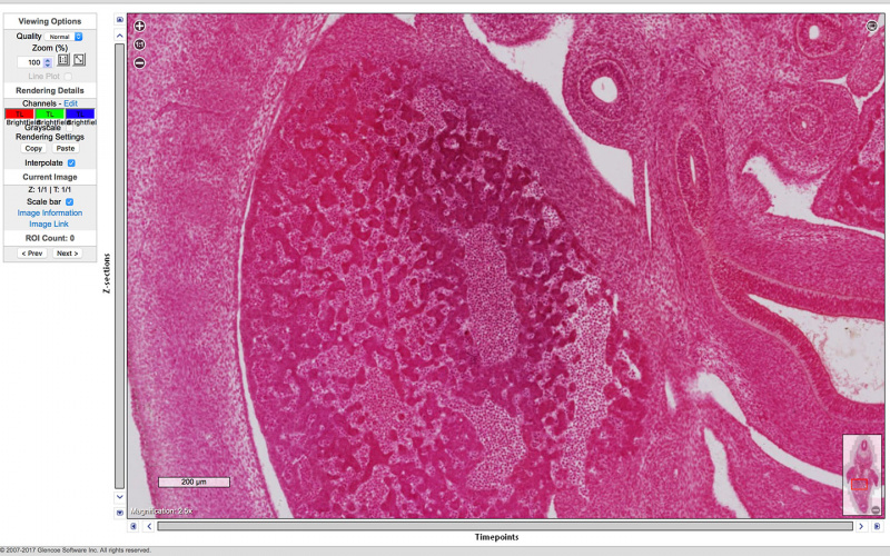 File:Blechschmidt-Embryo-1951-09-01-Slide-60-Scene11-3.jpg