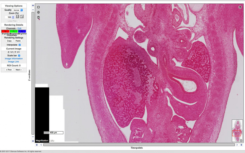 File:Blechschmidt-Embryo-1951-09-01-Slide-60-Scene11-2.jpg