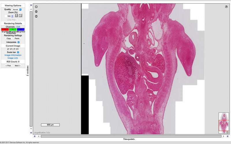 File:Blechschmidt-Embryo-1951-09-01-Slide-60-Scene11-1.jpg